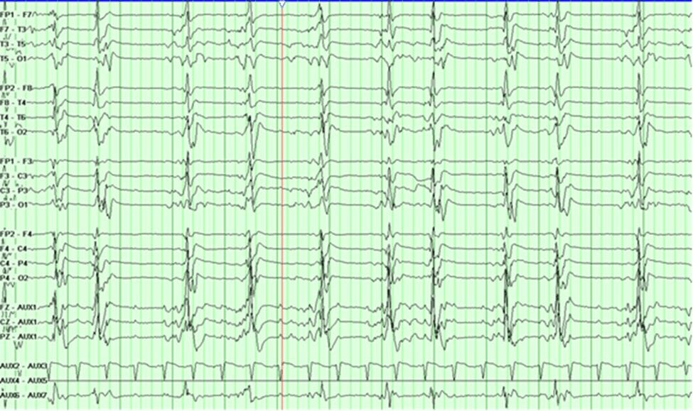 Neuroinfectious Disease Review and Practice Quiz | NowYouKnow Neuro