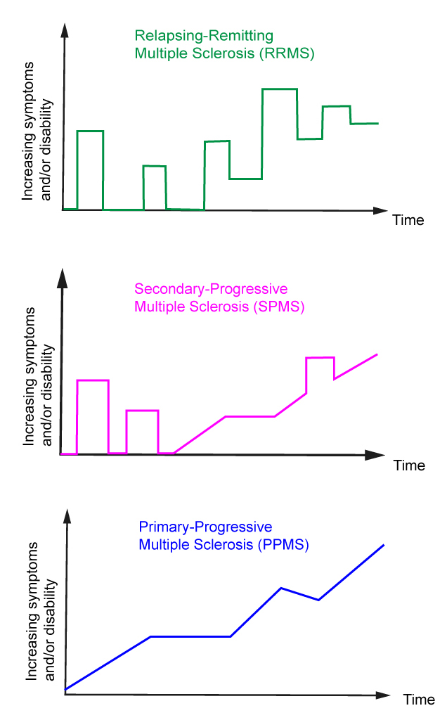 Multiple Sclerosis Diagram showing relapsing-remitting and primary-progressive course for neurology resident board exam review