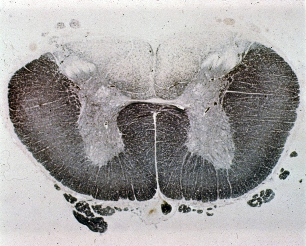 Spine & Cord Chapter and Practice Questions NowYouKnow Neuro
