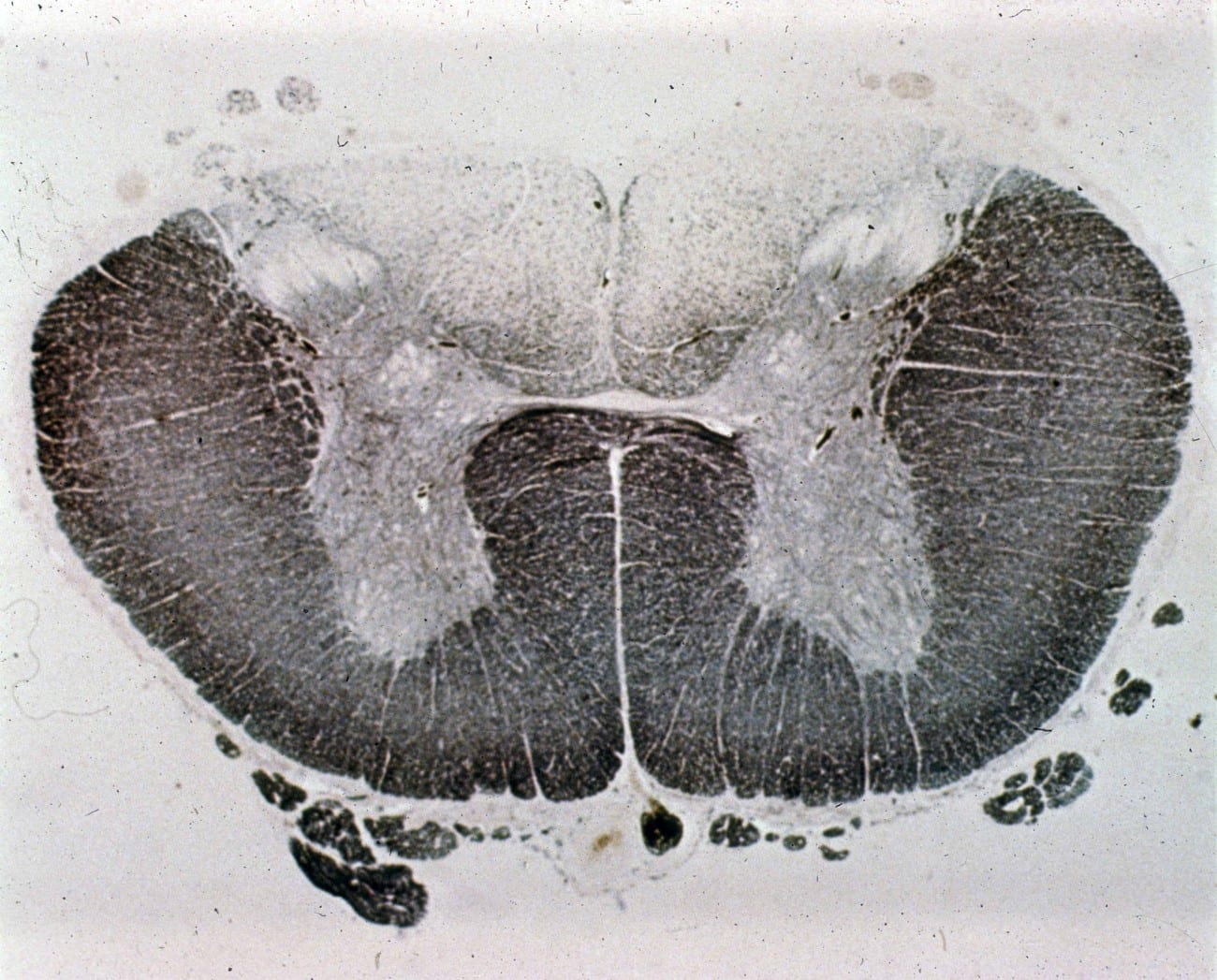 Spine & Cord Chapter and Practice Questions NowYouKnow Neuro