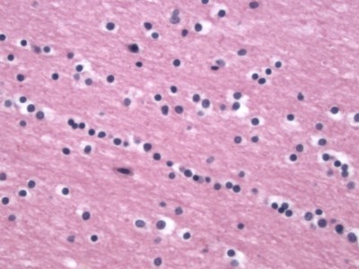 Normal Oligodendrocyte Normal Oligodendrocyte on pathology stain