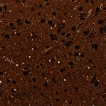 Neuritic Plaques Neuritic Plaques