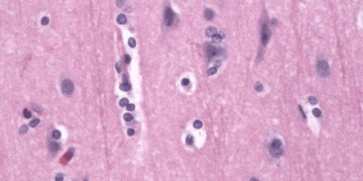 Normal Astrocytes normal Astrocytes in gray matter on H&E stain