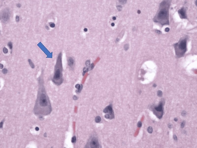 Normal neuron on a microscope specimen